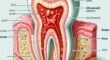 how-long-until-tooth-infection-kills-you